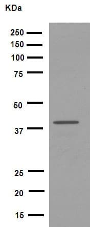 Anti-Fbx32 antibody [EPR9148(2)](AB168372)