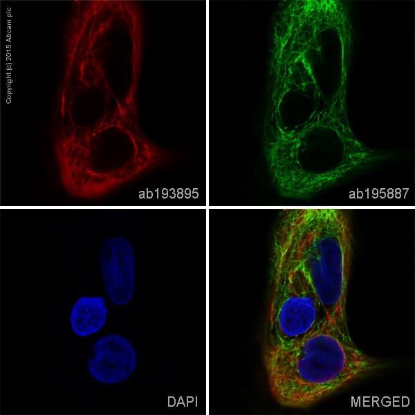 Alexa Fluor 647 Cytokeratin 5 Antibody Ep1601y Ab193895  Immunocytochemistry Immunofluorescence Img127098