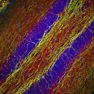 Anti-Neurofilament heavy polypeptide antibody(AB8135)