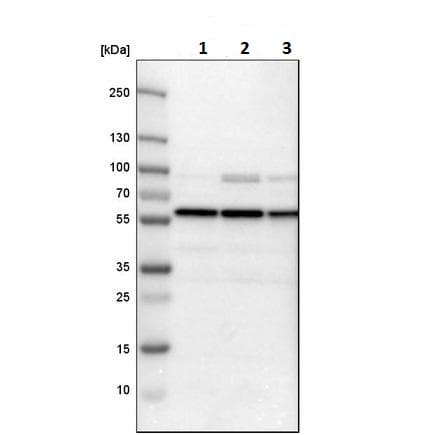 Anti-Proteasome 19S S4/PSMC1 antibody(AB223765)