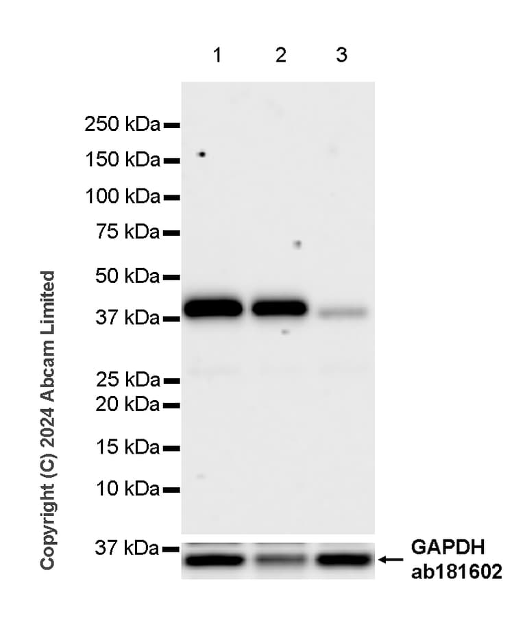 Ykl 40 Chi3l1 Antibody Rm1204 Bsa And Azide Free Ab319165  Western Blot Img434128