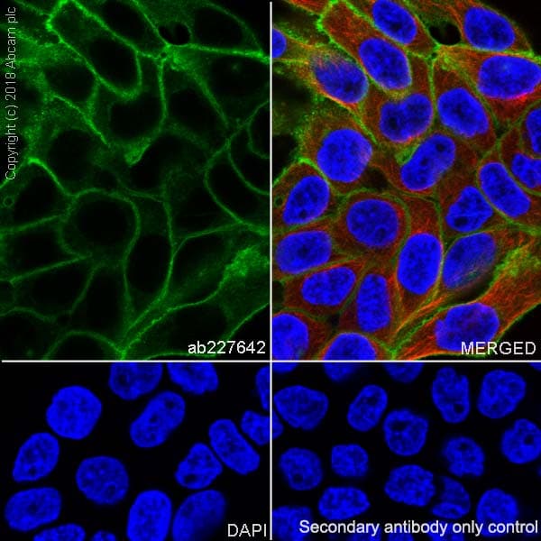Egfr Antibody Sp84 Bsa And Azide Free Ab238803  Immunocytochemistry Immunofluorescence Img72389