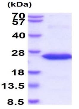 Recombinant Human Frataxin protein(ab95502)