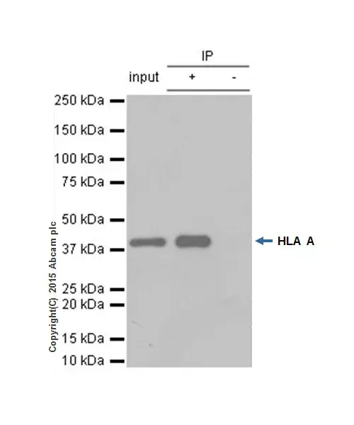 Anti-HLA A antibody [EP1395Y](AB52922)