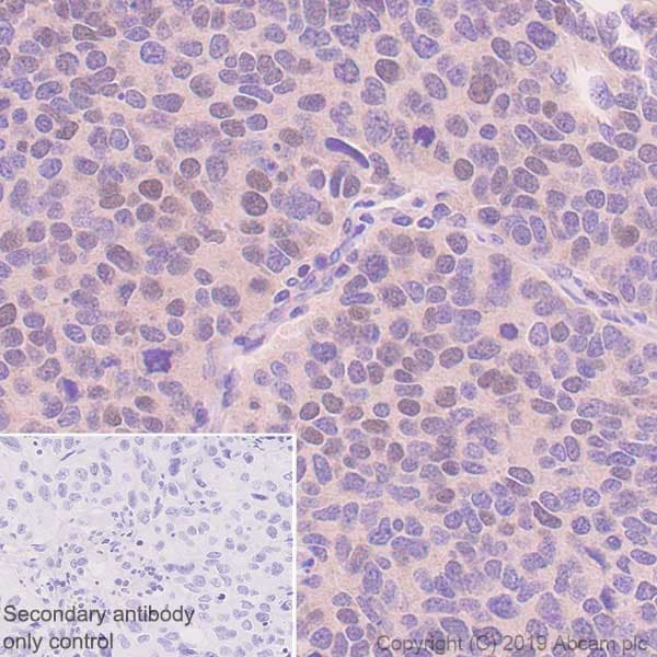 Hoxb4 Antibody Ep1919y Ab76093  Immunohistochemistry Formalin Pfa Fixed Paraffin Embedded Sections Img123958