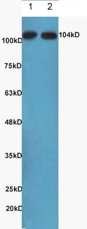 Anti-NFkB Inducing Kinase NIK antibody(AB216409)