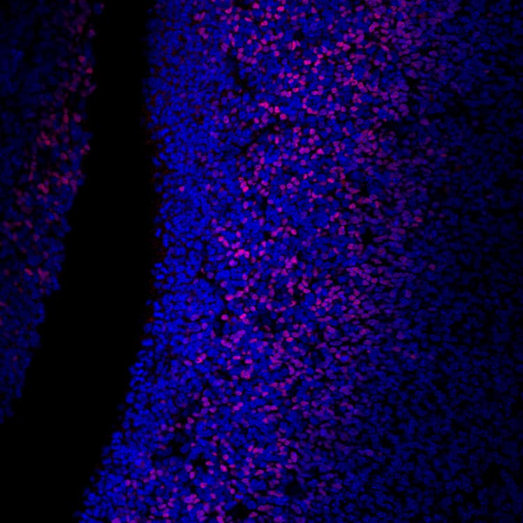 Alexa Fluor® 647 Anti-TBR2 / Eomes antibody [EPR19012](AB315356)