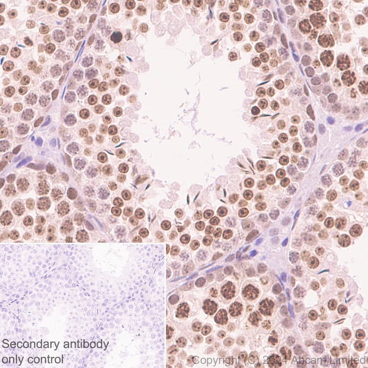 Dnmt1 Antibody Rm1192 Ab317845  Immunohistochemistry Formalin Pfa Fixed Paraffin Embedded Sections Img434465
