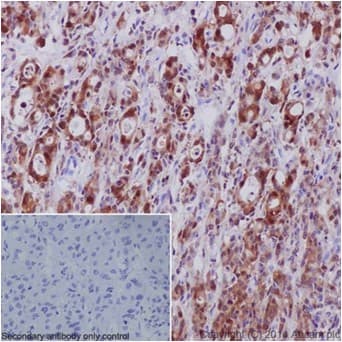 Anti-S100A4 antibody [EPR14639(2)](AB197896)