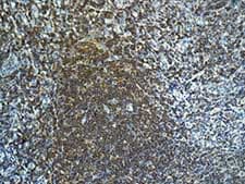 Anti-FOXO1A antibody [EPR12020](AB179450)