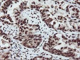 Samhd1 Antibody Oti1a1 Ab128107  Immunohistochemistry Formalin Pfa Fixed Paraffin Embedded Sections Img108884