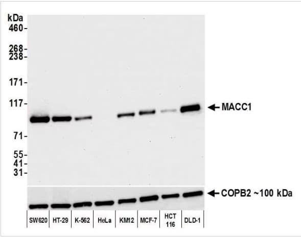 Anti-MACC1 antibody [BLR135H] - BSA free(AB314047)