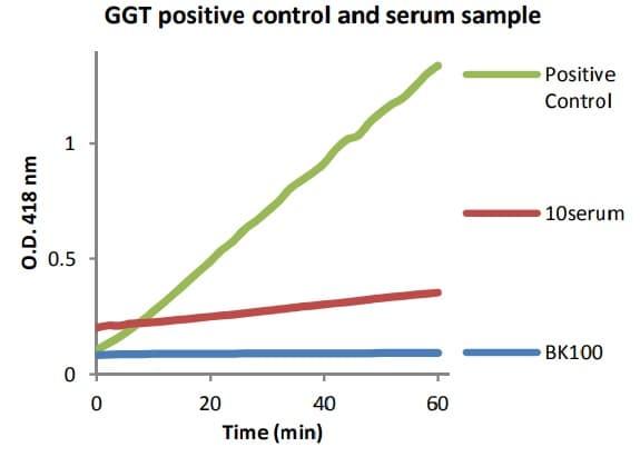 Gamma Glutamyl Transferase (GGT) Assay Kit (Colorimetric)(ab241029)