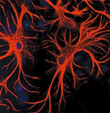 Anti-GFAP antibody(AB134436)