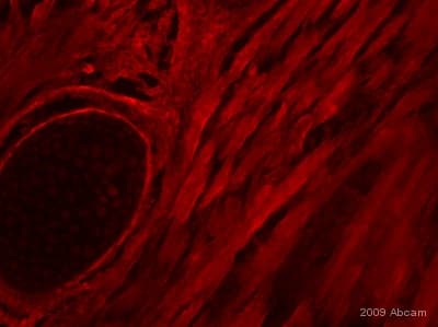 Anti-Myogenin antibody [F5D](AB1835)