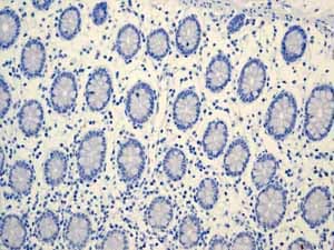 Anti-MUC16 antibody [EPR1020(2)](AB110640)