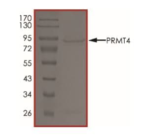 Recombinant human CARM1 protein (Active)(AB268888)