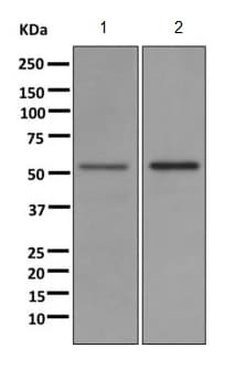 Anti-UGT1A1 antibody [EPR9592](AB170858)