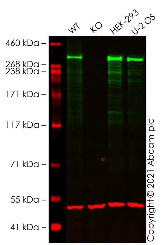 Anti-ATM antibody [EPR20100] - ChIP Grade(AB201022)