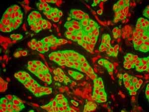 Anti-Cytokeratin 8 antibody [EP1628Y] - Cytoskeleton Marker(AB53280)