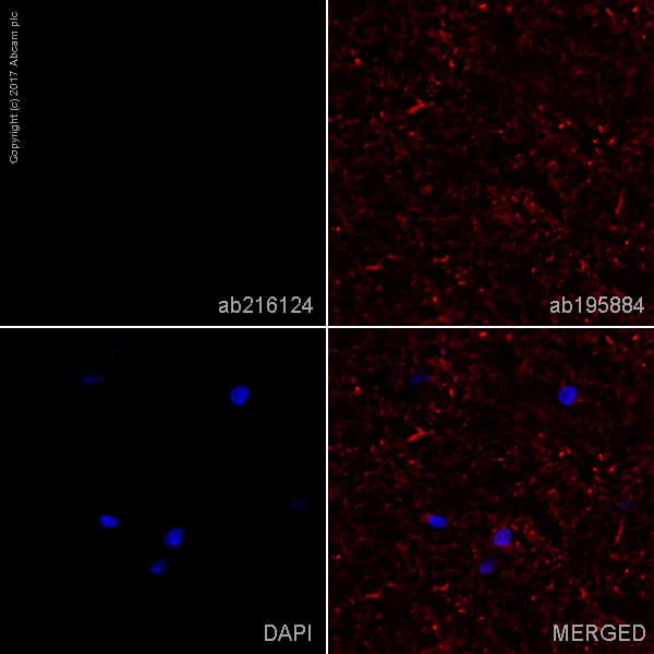 Alexa Fluor 488 Alpha Synuclein Aggregate Antibody Mjfr 14 6 4 2 Conformation Specific Ab216124  Immunohistochemistry Frozen Sections Img15696