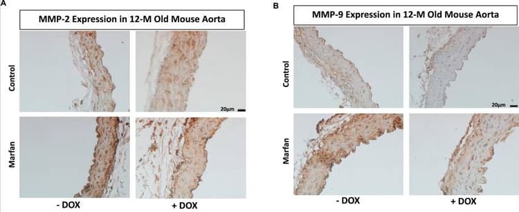 Mouse and Rabbit Specific HRP/DAB IHC Detection Kit - Micro-polymer(AB236466)