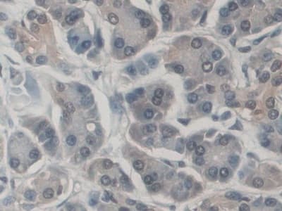 Cd300c Antibody Ab232789  Immunohistochemistry Formalin Pfa Fixed Paraffin Embedded Sections Img86213