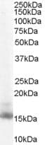 Rbp1 Antibody Ab104452  Western Blot Img113537