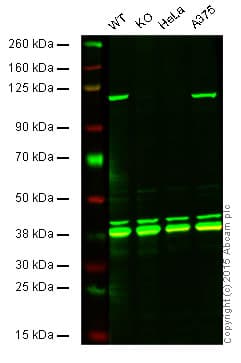 Msh2 Antibody Epr3943 Ab92473  Western Blot Img57374