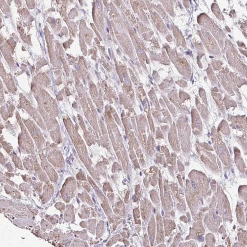 Il 18bp Antibody Ab204487  Immunohistochemistry Formalin Pfa Fixed Paraffin Embedded Sections Img10219