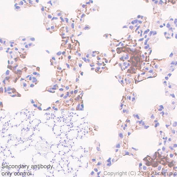 Anti-Fibrinogen alpha chain antibody [EPR2919](AB92572)