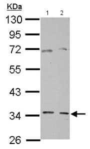 Ggps1 Antibody Ab155584  Western Blot Img82411