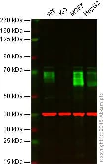 Anti-GBA antibody [EPR5143(3)] - BSA and Azide free(AB215260)