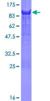 Recombinant Human YAP1 protein(AB132459)