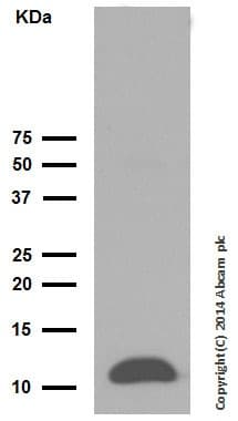 Anti-Trefoil Factor 3 antibody [EPR3974](AB108599)