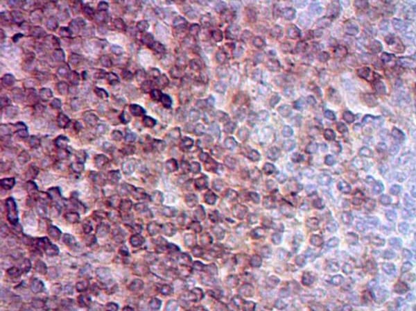 Anti-CD3 epsilon antibody(ab5690)