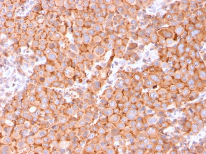 Anti-Uroplakin Ib/UPIb antibody [UPK1B/3081](AB263454)