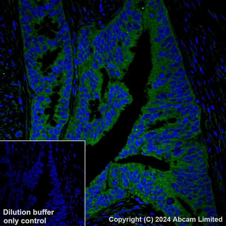 Alexa Fluor 488 Gbp1 Antibody Epr8285 Ab320704  Immunohistochemistry Formalin Pfa Fixed Paraffin Embedded Sections Img435003