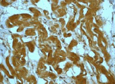 Anti-MEK4/MKK4 (phospho S80) antibody [EP1075Y] - BSA and Azide free(AB284698)