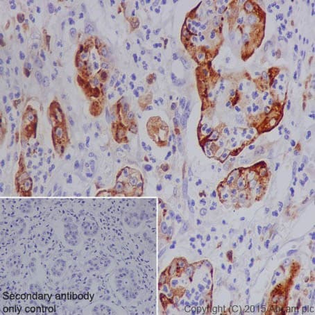 Anti-MMP7 antibody [EPR17888-101](AB205525)