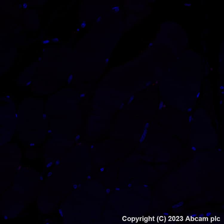 Alexa Fluor® 555 Anti-Mannose Receptor antibody [EPR22489-7](AB313731)