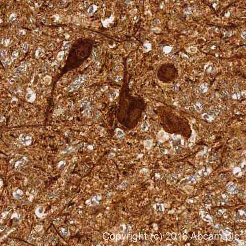 Alpha Synuclein Antibody Mjfr1 Bsa And Azide Free Ab209420 Immunohistochemistry Formalin Pfa Fixed Paraffin Embe ViHUDjuSh9