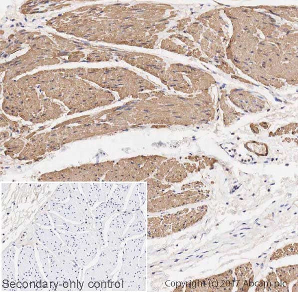 Anti-TAGLN/Transgelin antibody [EPR21206](AB213273)