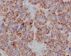 Cd1e Antibody Epr15746b Bsa And Azide Free Ab250917  Immunohistochemistry Formalin Pfa Fixed Paraffin Embedded Sections Img81667