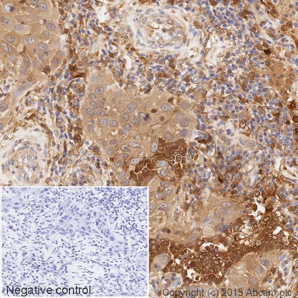 HRP Anti-Galectin 3 antibody [EP2775Y](AB202553)