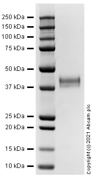 Recombinant Human Cathepsin B protein (Active)(AB283434)