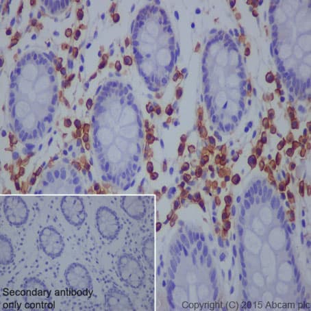 Anti-Syndecan-1 antibody [EPR6454](AB128936)