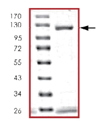 Ab63175  Sds Page Img24430