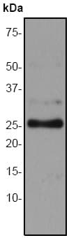 Anti-C Reactive Protein antibody [EPR283Y] - BSA and Azide free(AB247307)