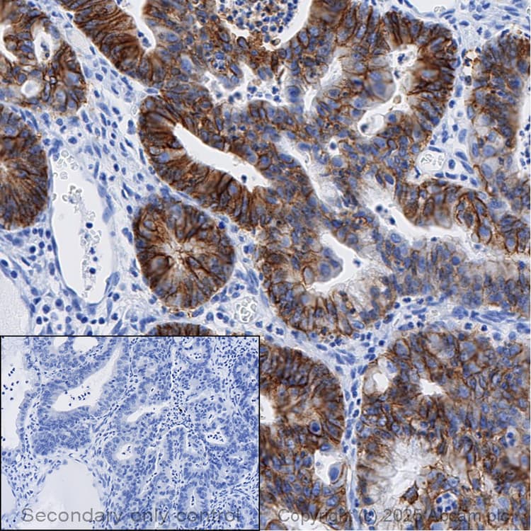 Anti-EpCAM antibody [EPR20532-225](AB223582)